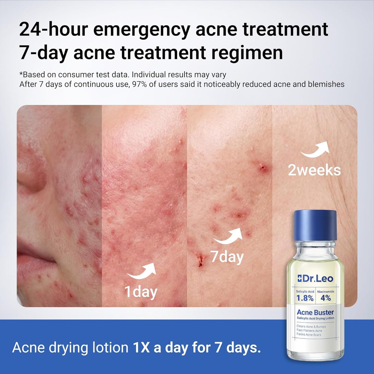 ClearFast Salicylic Spot Serum within 15 days