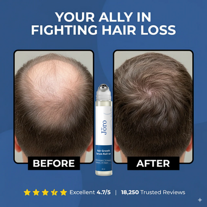 Premium Hair Growth Roll-On Serum